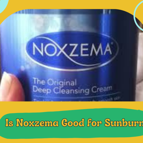 Is Noxzema Good for Sunburn?